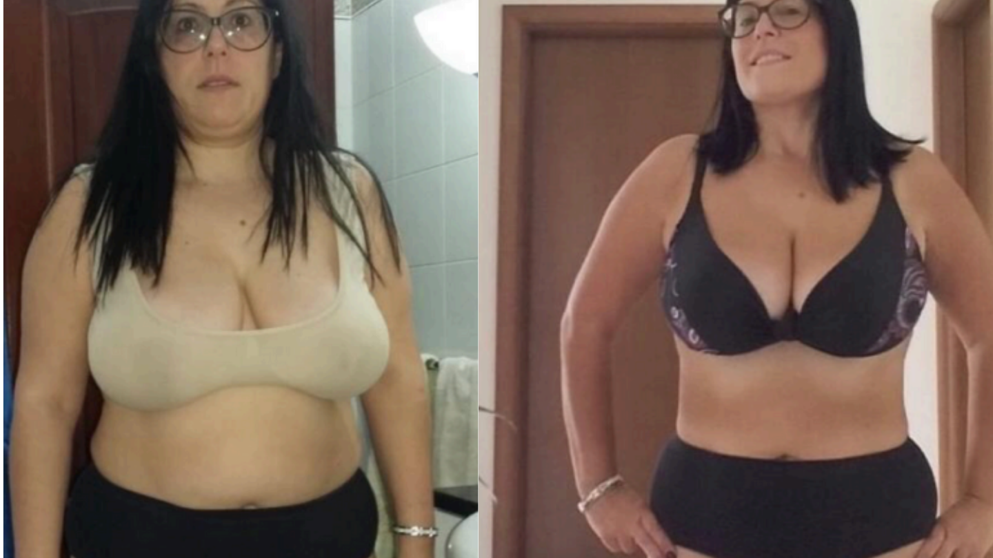 Maria — confronto Prima e Dopo