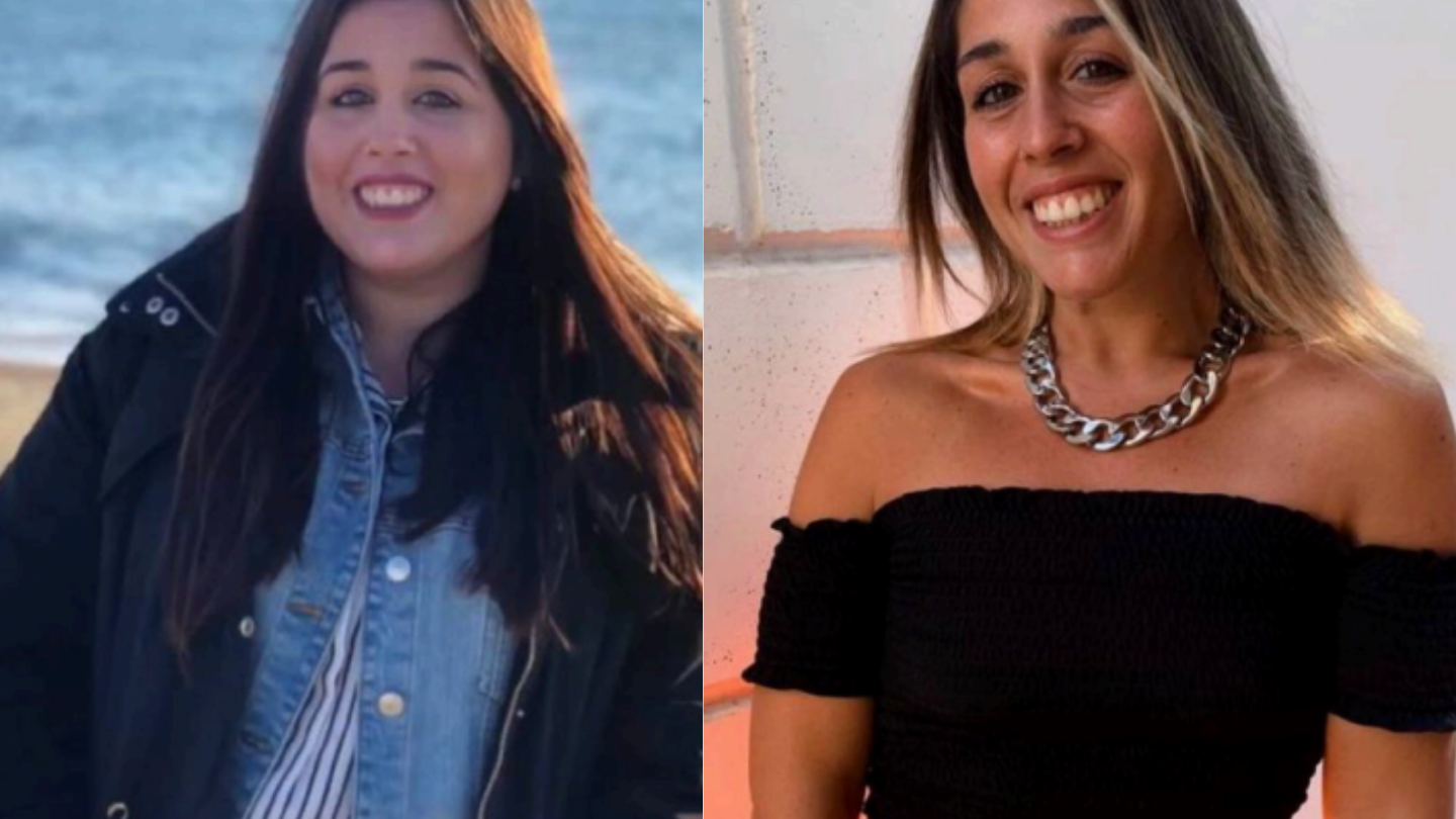Federica — confronto Prima e Dopo